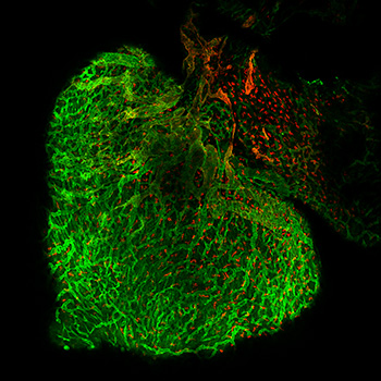 Blood and lymphatic vessels in normal mouse embryonic heart at E14.5.Whole-mount immunostaining labeled with CD31 (green) and LYVE1 (red).